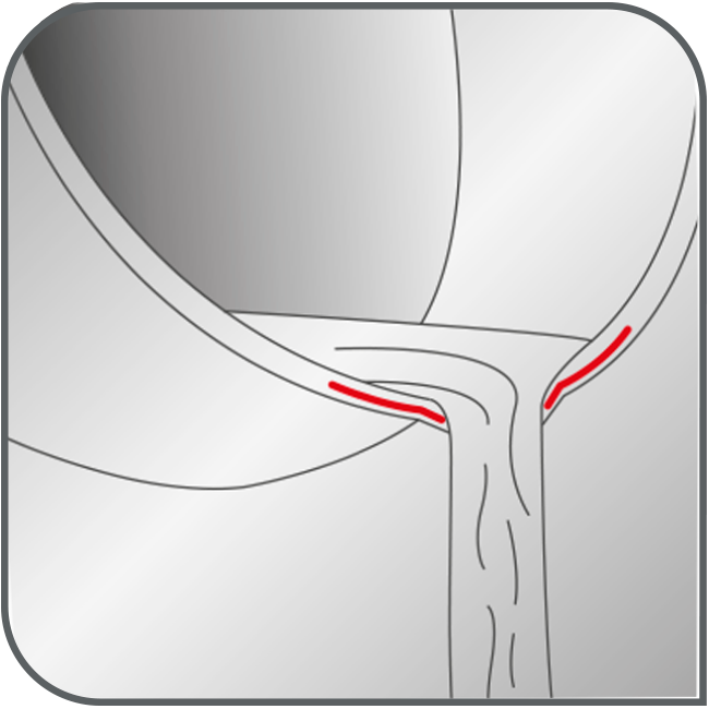 Excellence Stielkasserolle 16 cm G26928